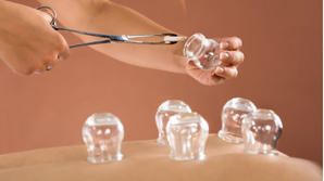 How Is Cupping Therapy Performed?