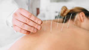 Acupuncture, How Acupuncture is Applied?